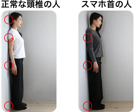 ストレートネック・スマホ首のセルフチェック画像